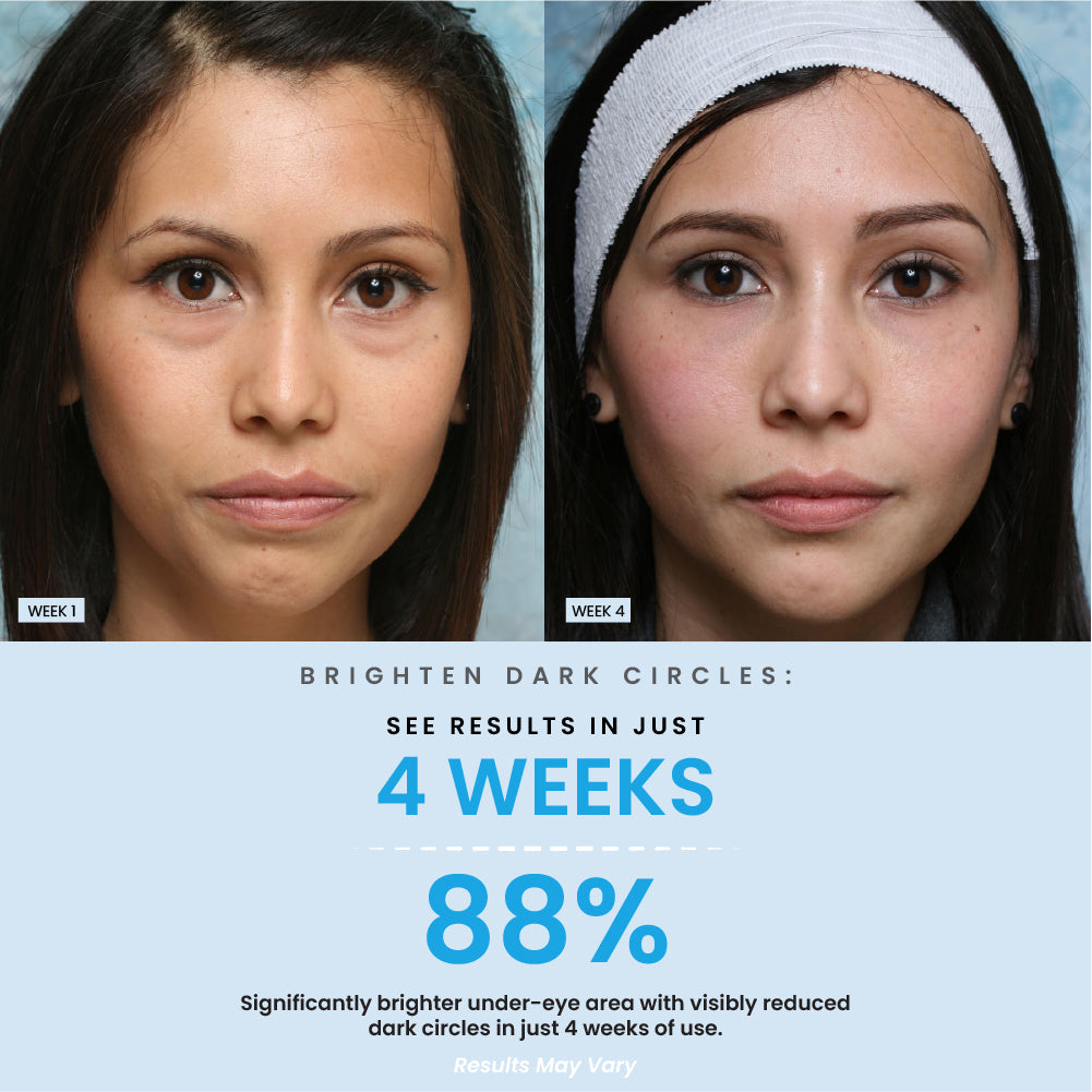 Under Eye Brightening Cream Result