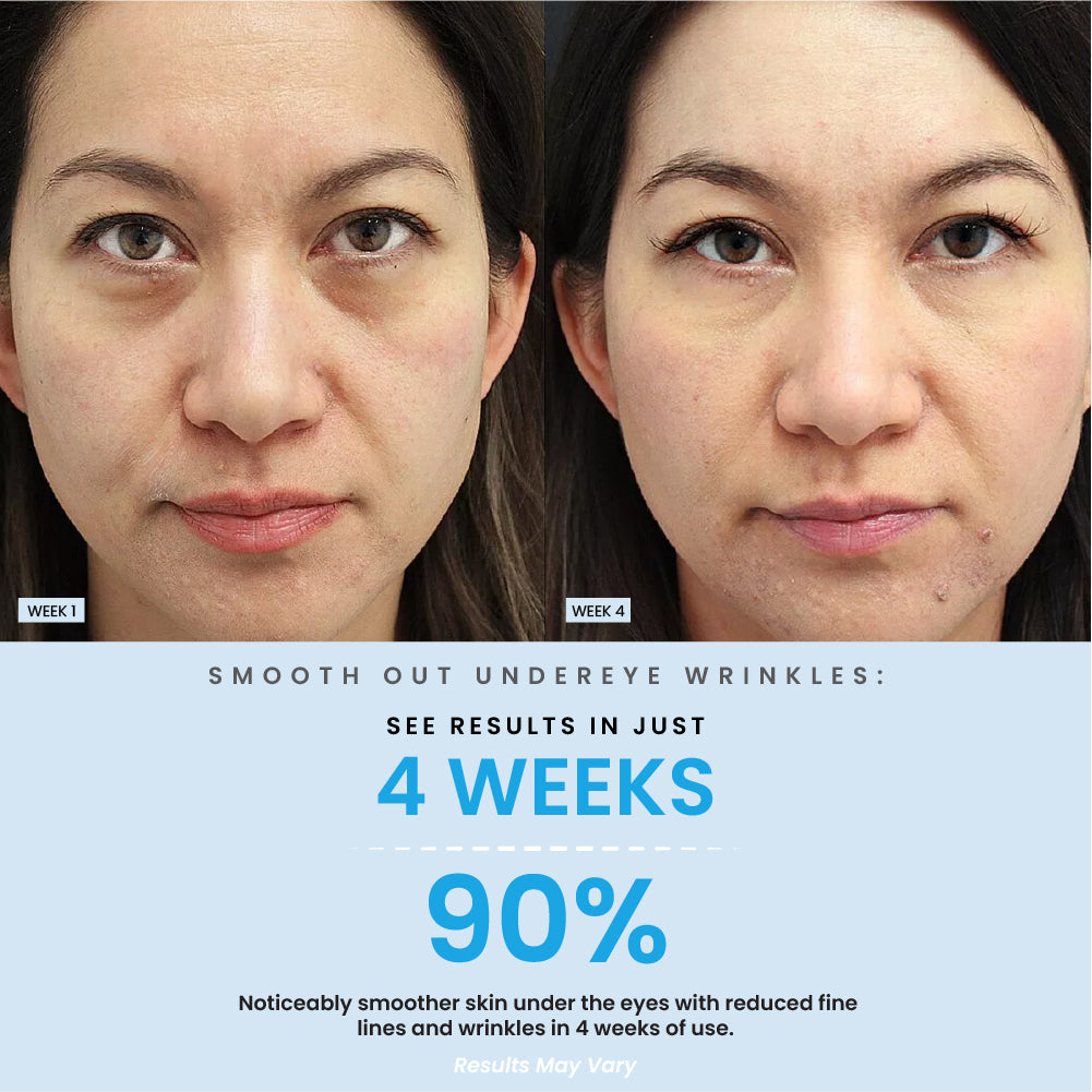 Under Eye Brightening Cream Result
