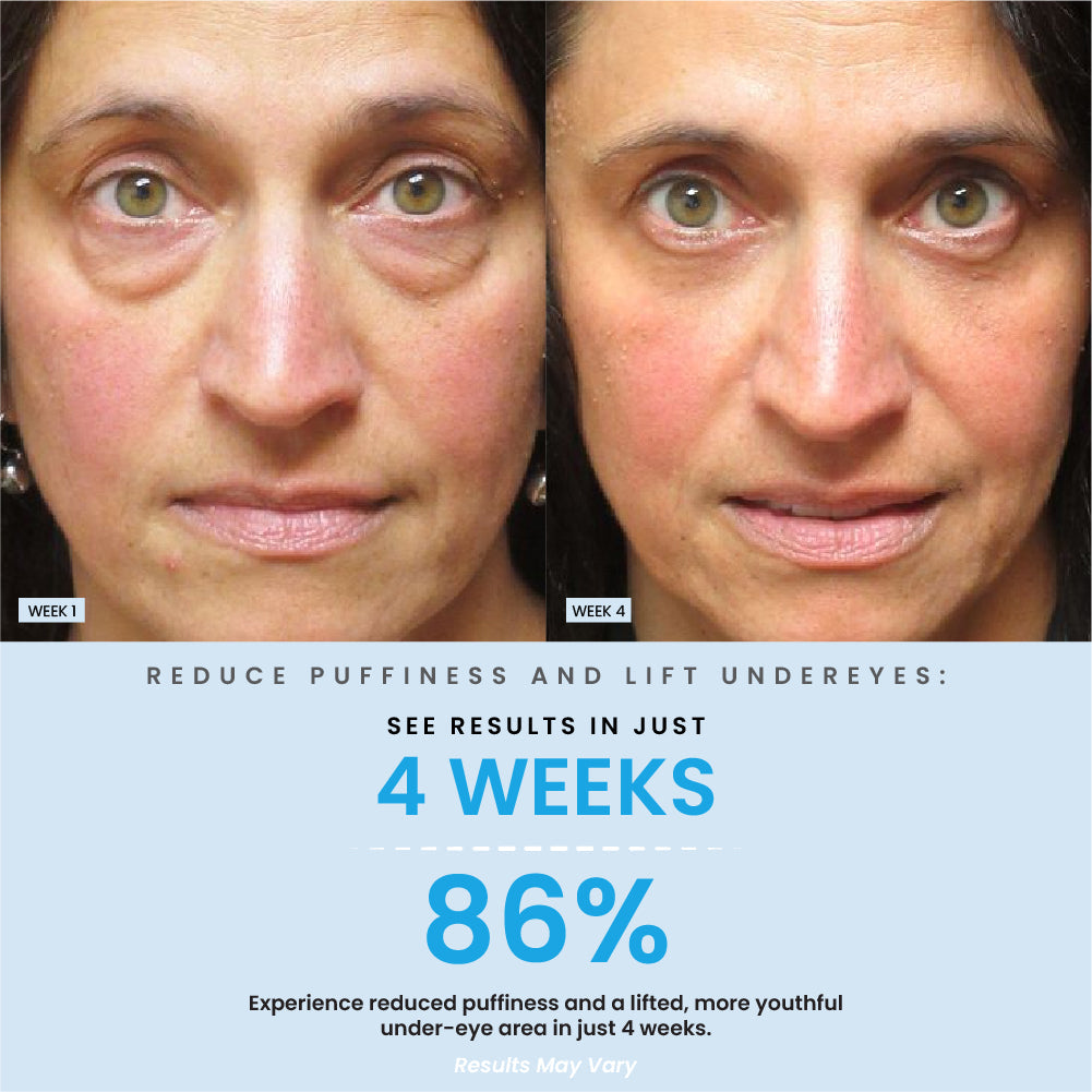 Under Eye Brightening Cream Result