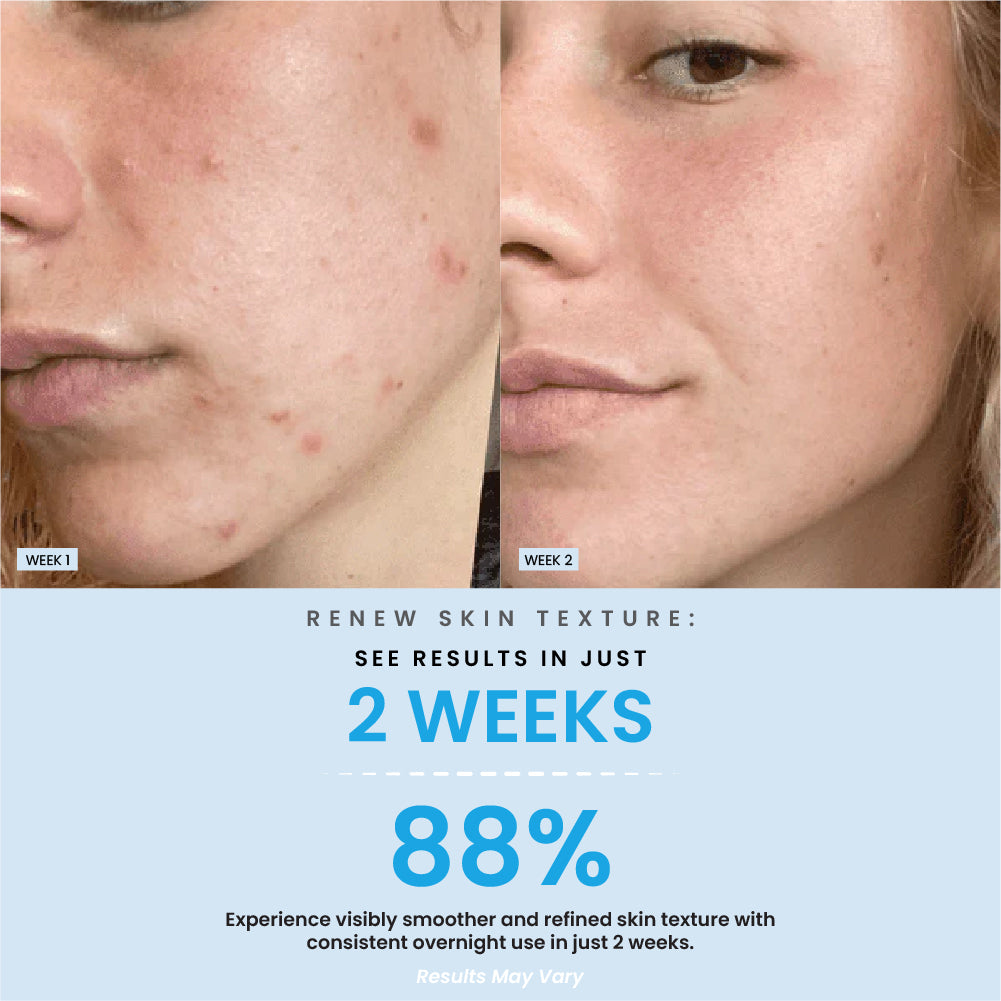 Overnight Collagen Mask (Q)