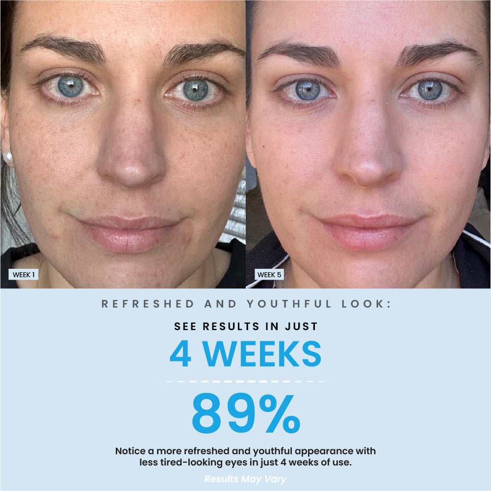 Under Eye Brightening Cream Result