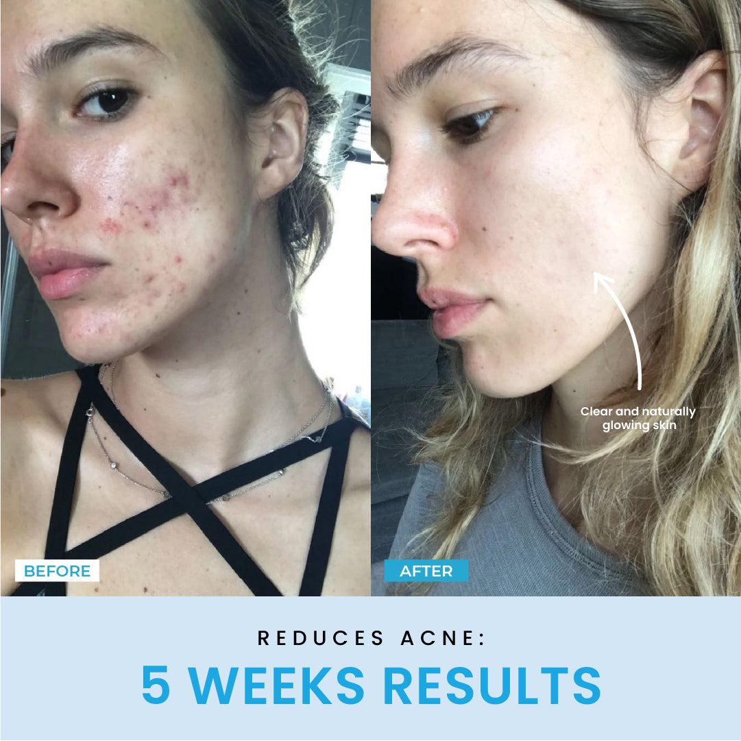 5 Weeks Result