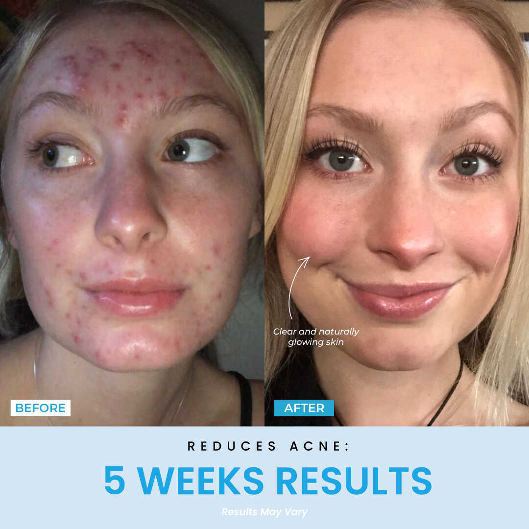 5 Weeks Result