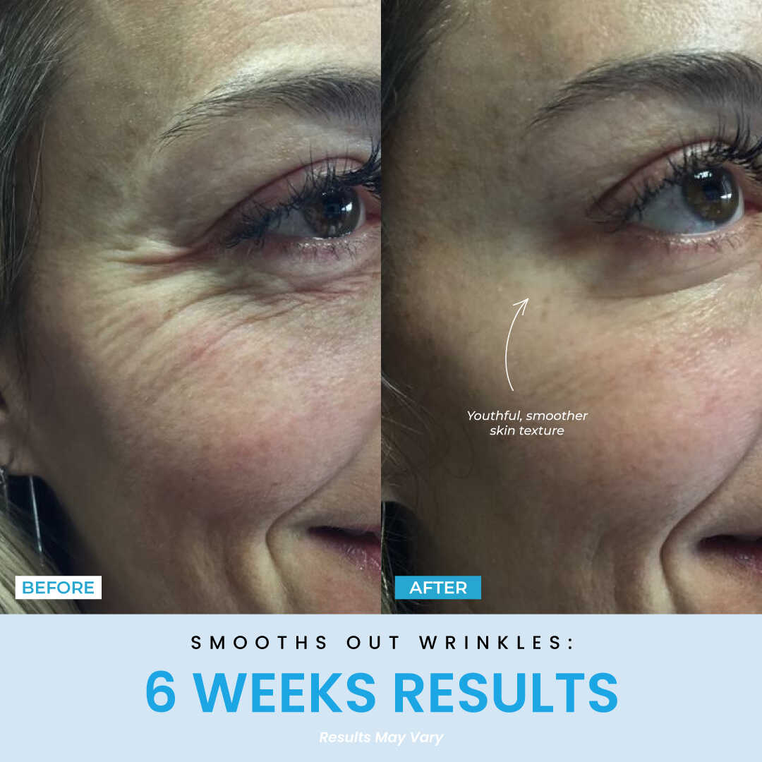 6 Weeks Result
