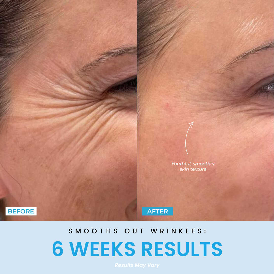 6 Weeks Result