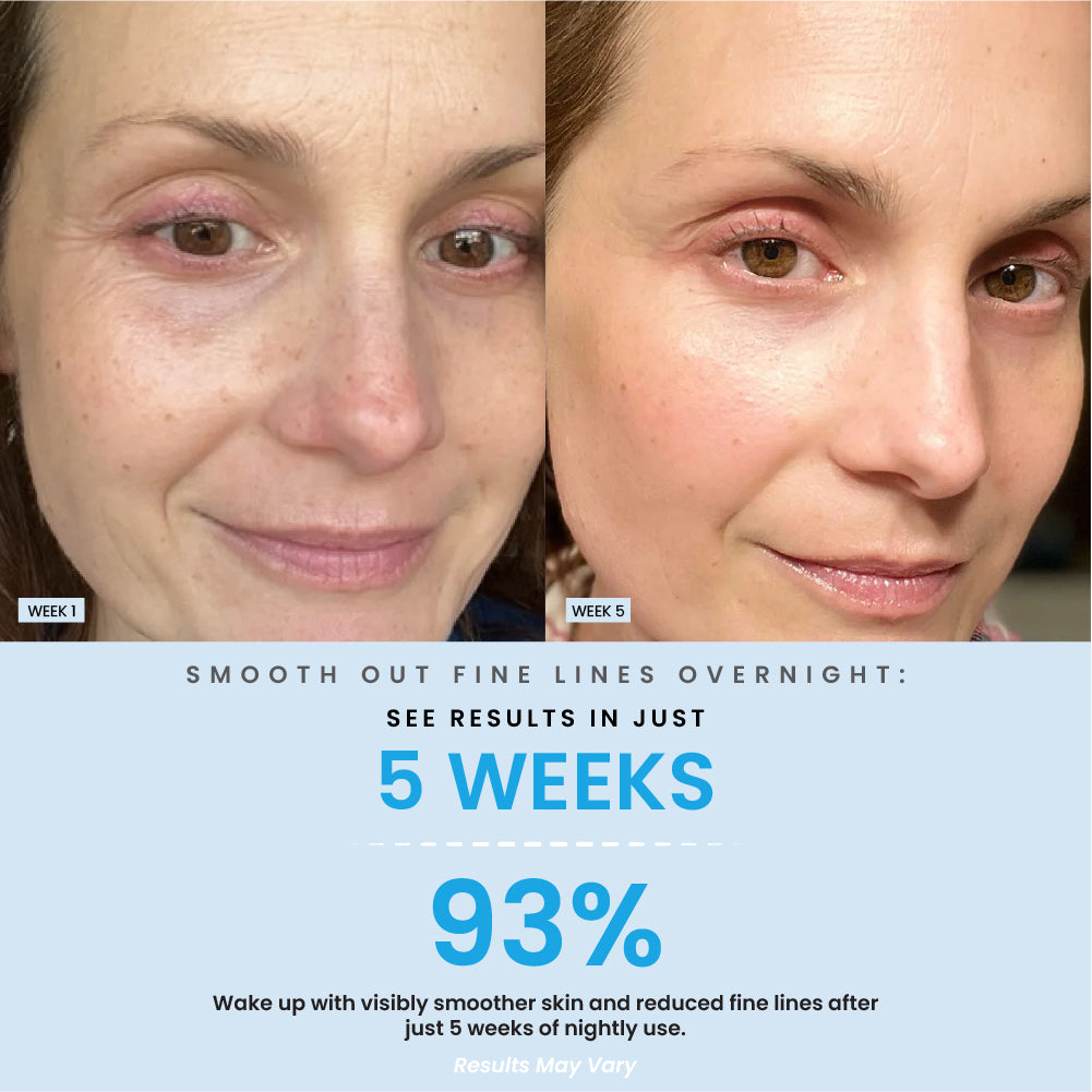 Overnight Retinol Anti Aging Cream Result