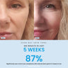 Liftlab Anti-Aging Daily Serum Result